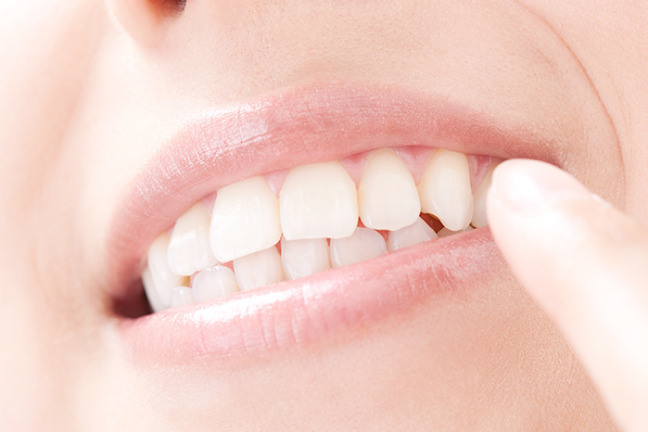 歯の表面の汚れを綺麗に落とすクリーニング