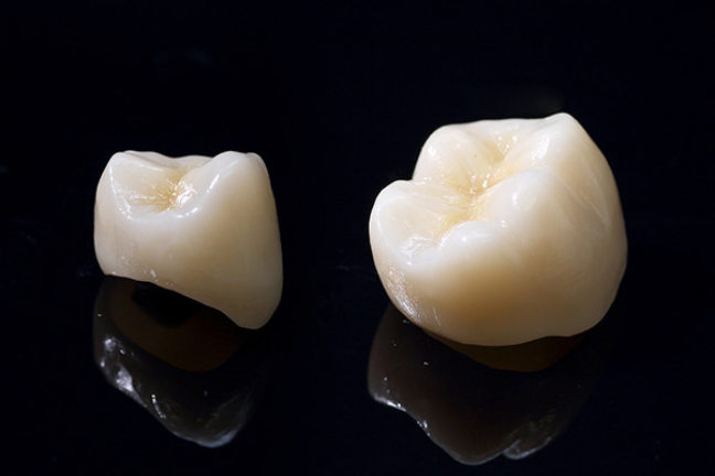 オールセラミック