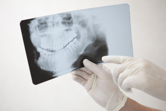 レントゲン撮影や型取りなどの各種検査をします。